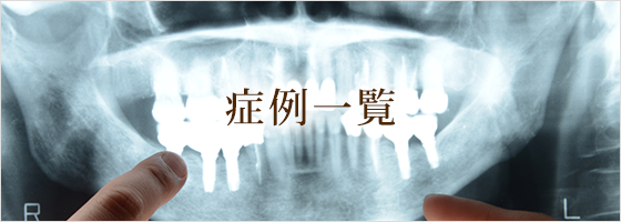 症例一覧